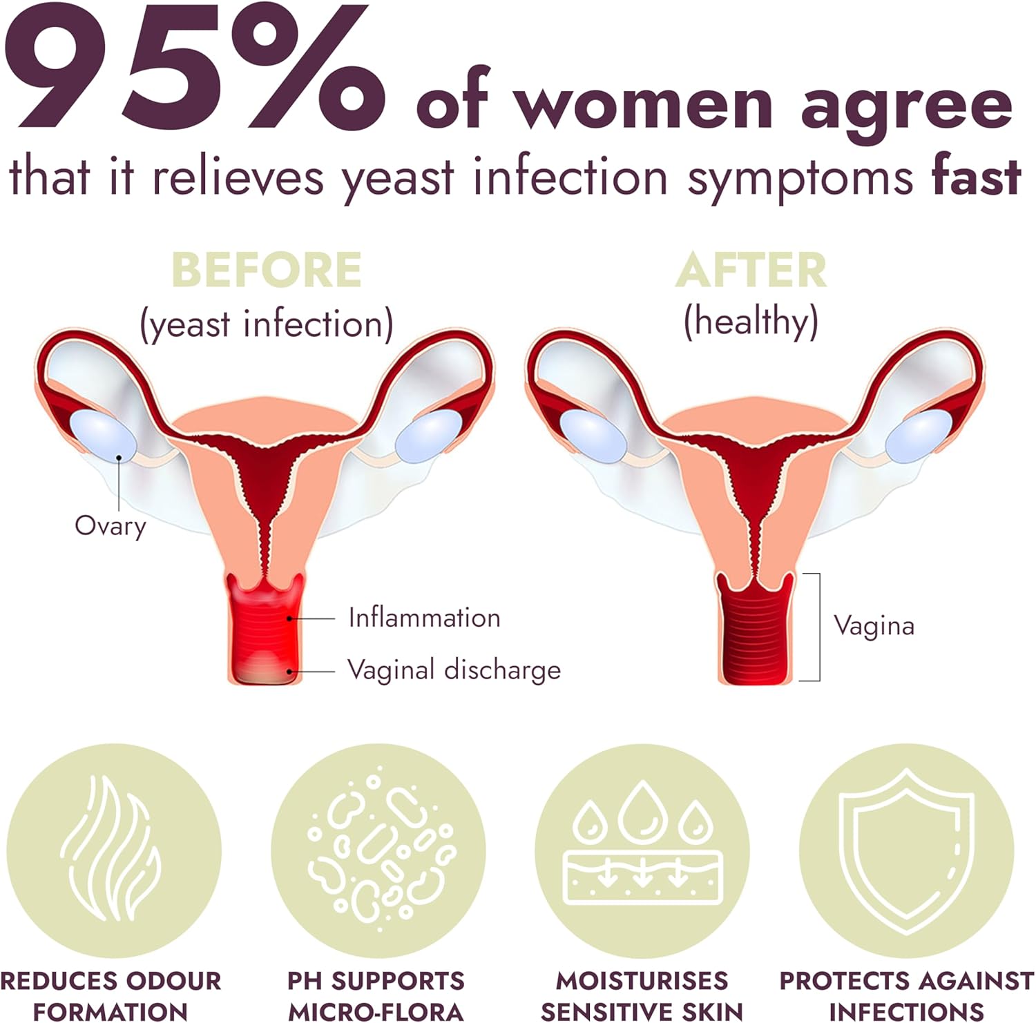 Yeast Infection Treatment for Women | Boric Acid Suppositories For Women | Helps Relieve Itching & Irritation | Vaginal Aid for Inflammation, Dryness & Watery Discharge | 12 Vaginal Suppositories - Image 3