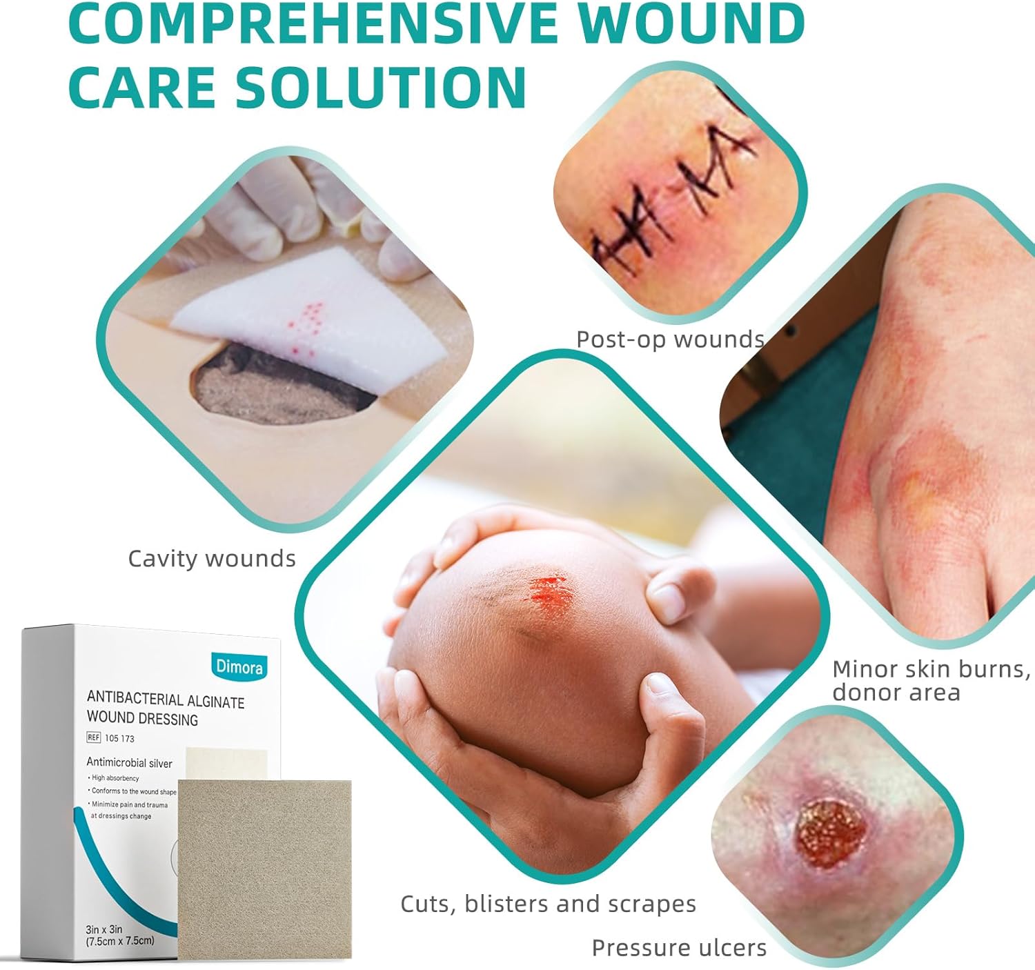 Dimora Upgrade Silver Calcium Alginate Wound Dressing -Antibacterial Non Stick Gauze for Wounds Care, Highly Absorbent Sterile Bandage Pads with Ag, 2'' x 2'' Patches 12 Packs Individual - Image 2